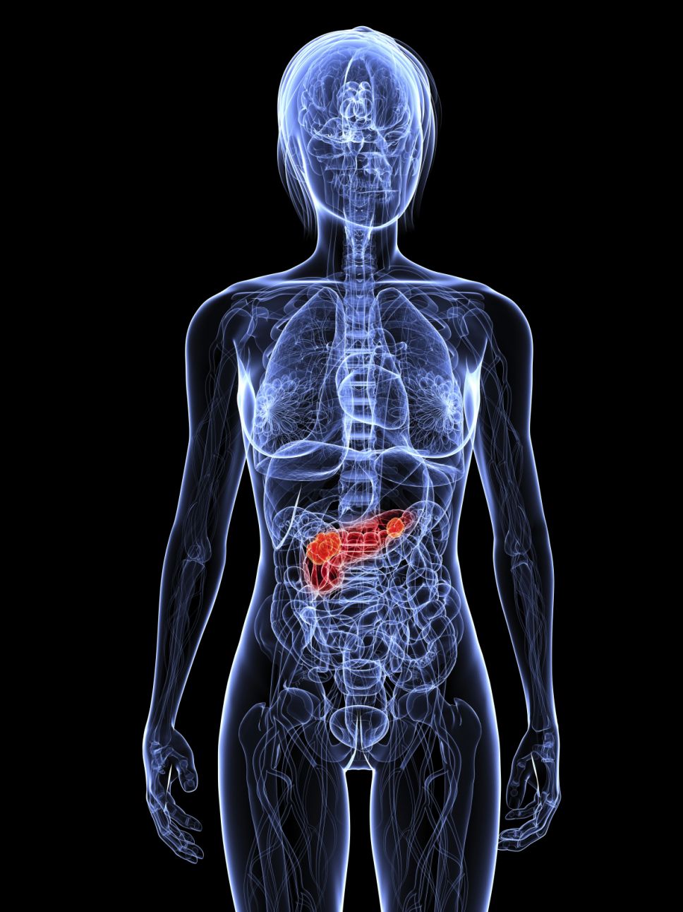 image_of_pancreas_cancer