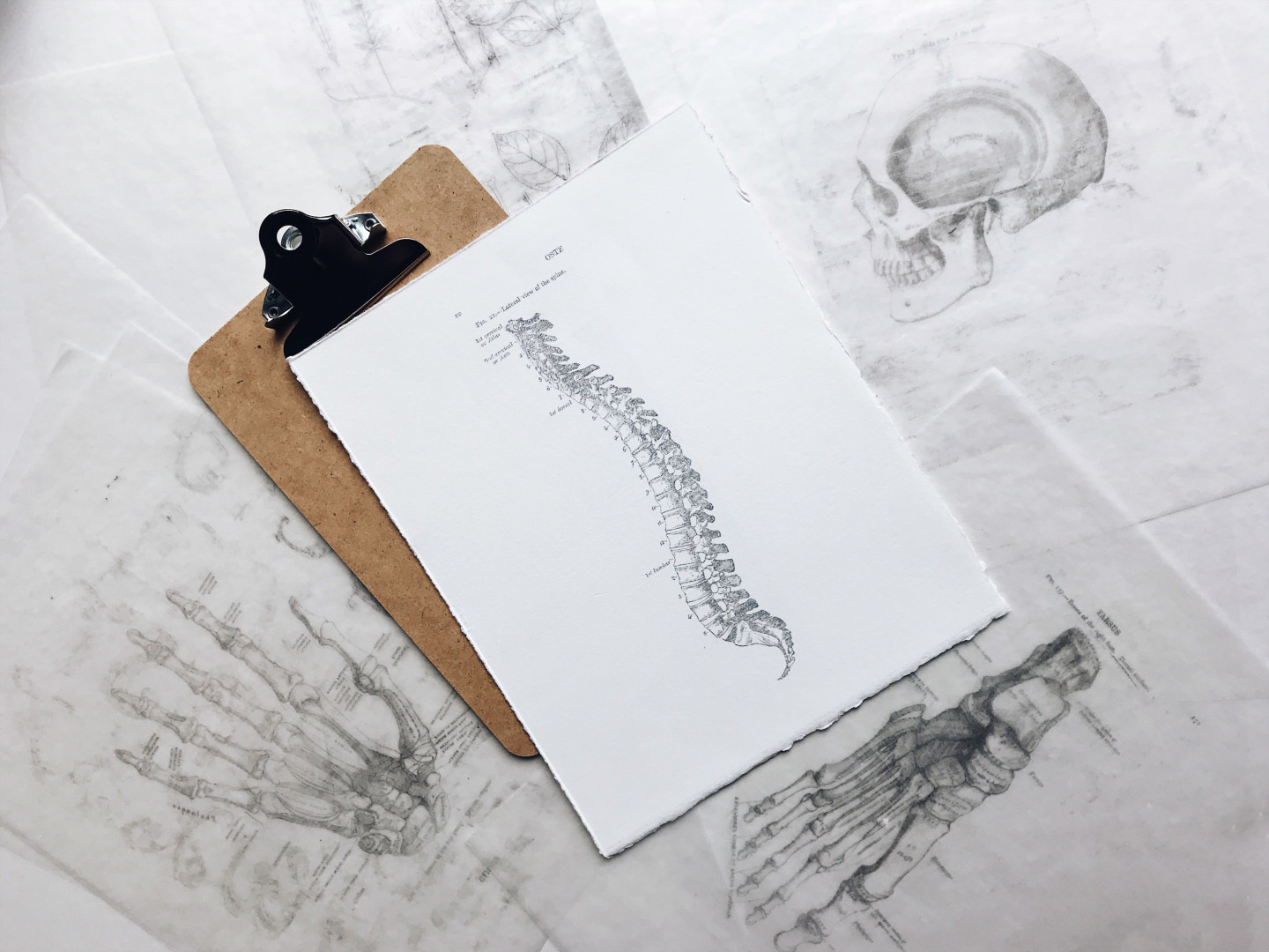 spine discitis-medical-negligence-claims-issues