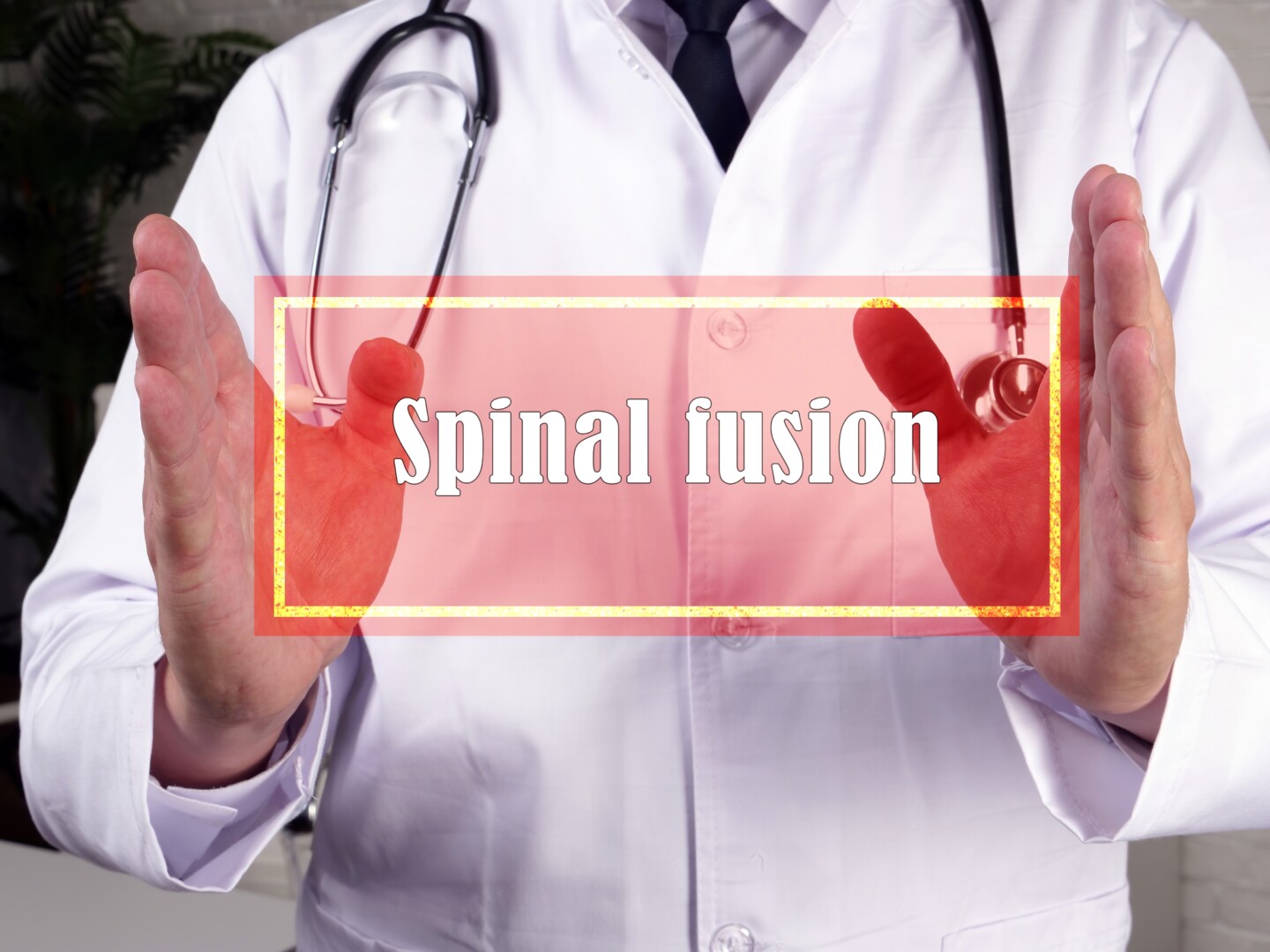 Spinal,Fusion,Arthrodesis,Inscription,On,The,Piece,Of,Paper.